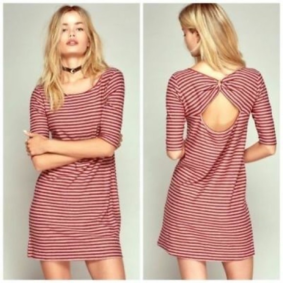 We The Free Frenchie Striped Open Back Dress - Picture 2 of 7